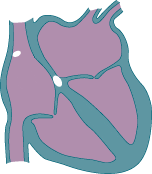  Κάθε διαταραχή του ονομάζεται αρρυθμία.